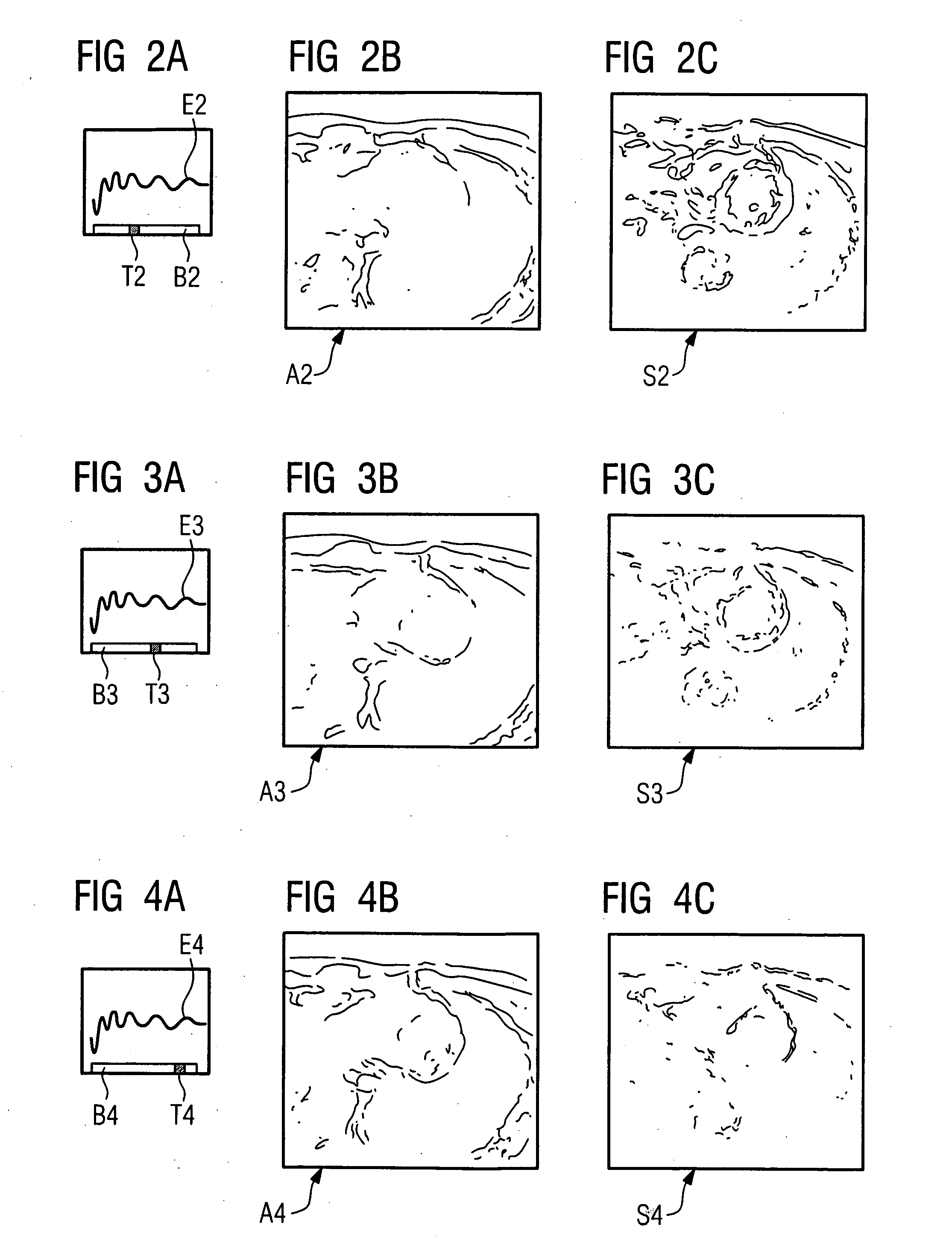 Method for generating an image exposure of the heart requiring a preparation