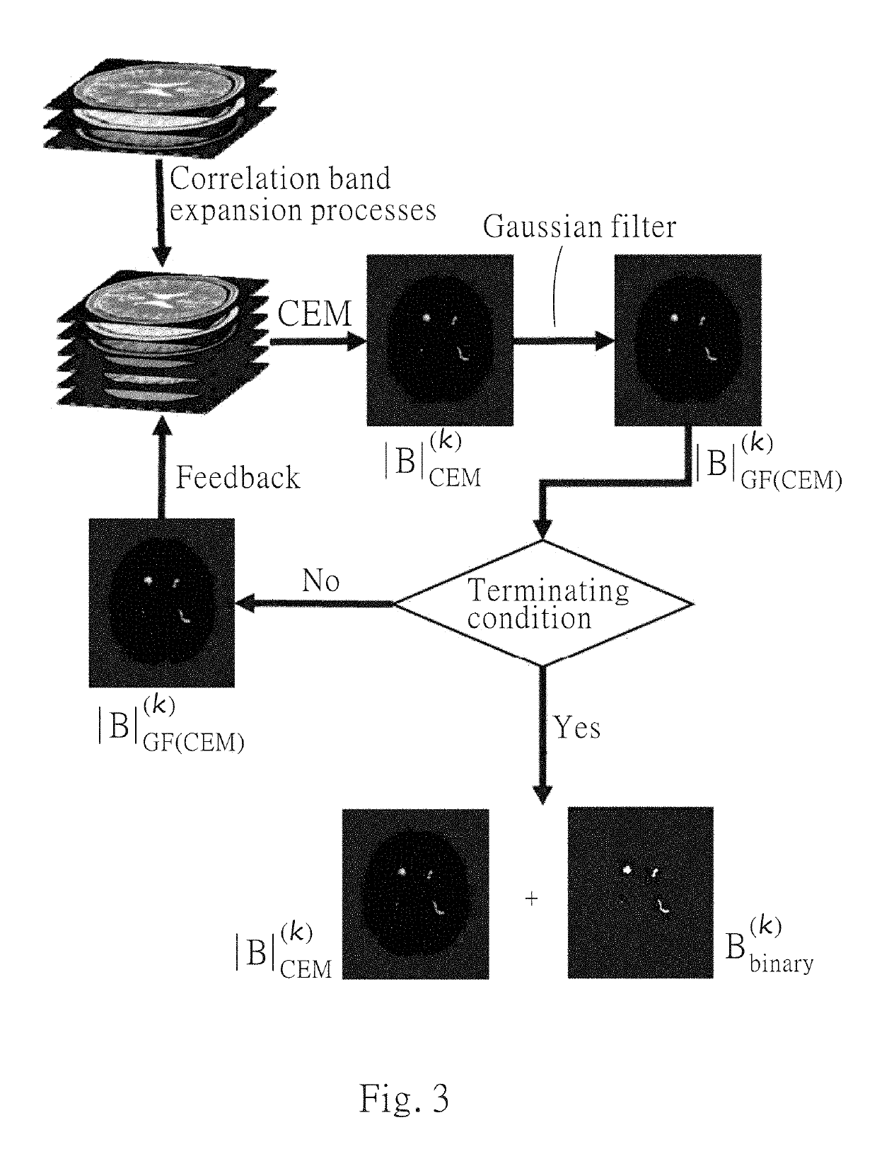 Iterative analyzing method for a medical image