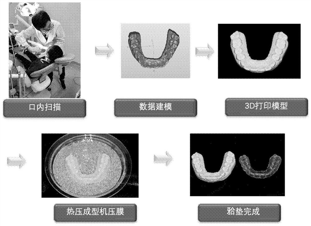 Digital preparation method of intraoral protection device for fixing tooth trauma