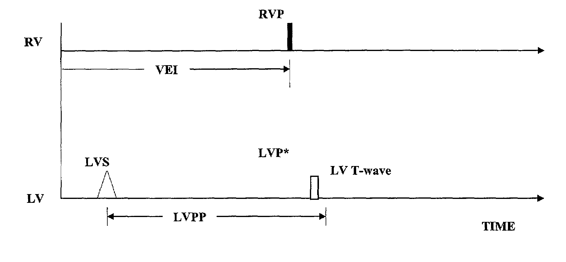 System and method for cardiac rhythm management with dynamically adjusted synchronized chamber pacing protection period