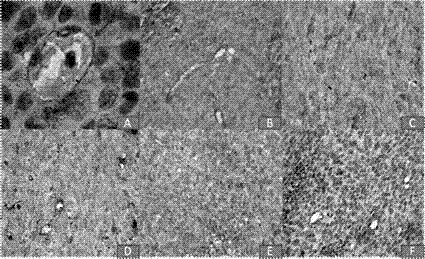 Traditional Chinese medicine composition for inhibiting vasculogenic mimicry and angiogenesis of intestinal cancer and application thereof