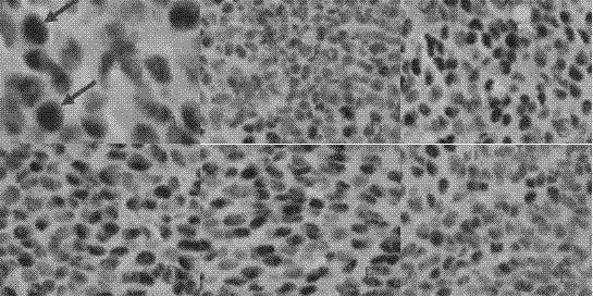 Traditional Chinese medicine composition for inhibiting vasculogenic mimicry and angiogenesis of intestinal cancer and application thereof