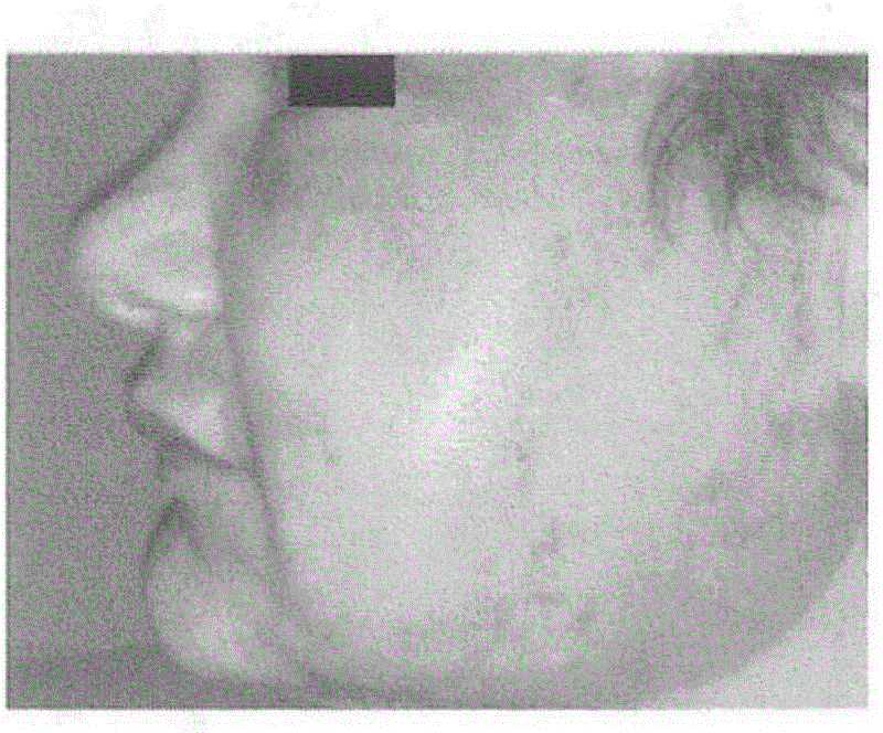 Post-procedure skin care systems, compositions, and methods of use thereof