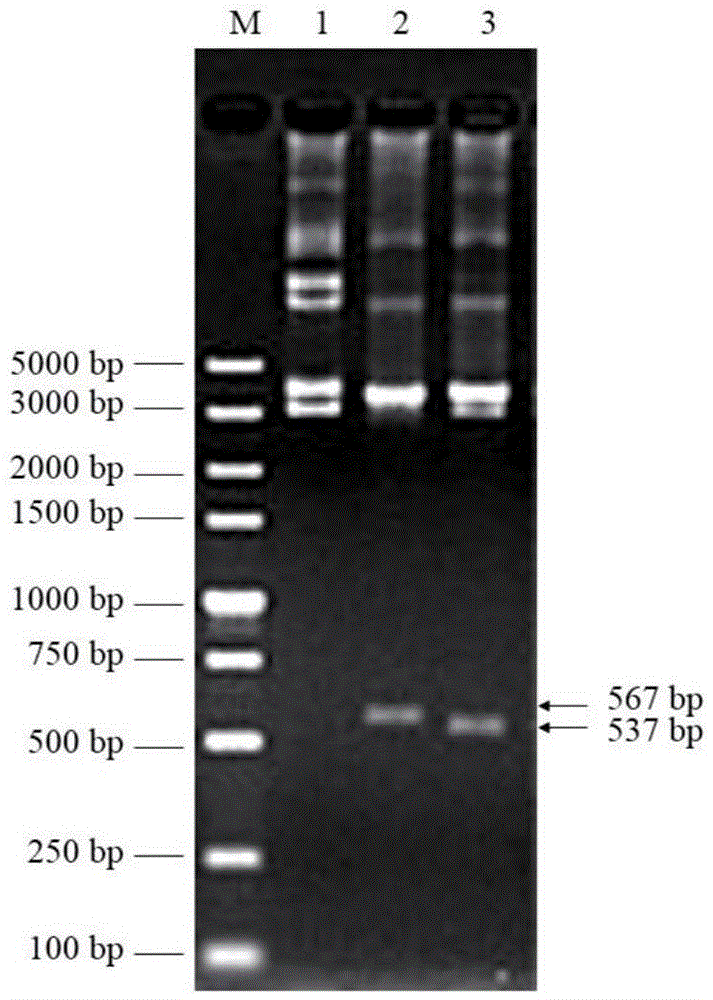 Lyase of bacteriophage and sterilization application