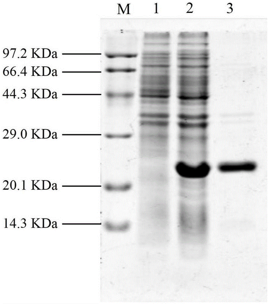 Lyase of bacteriophage and sterilization application