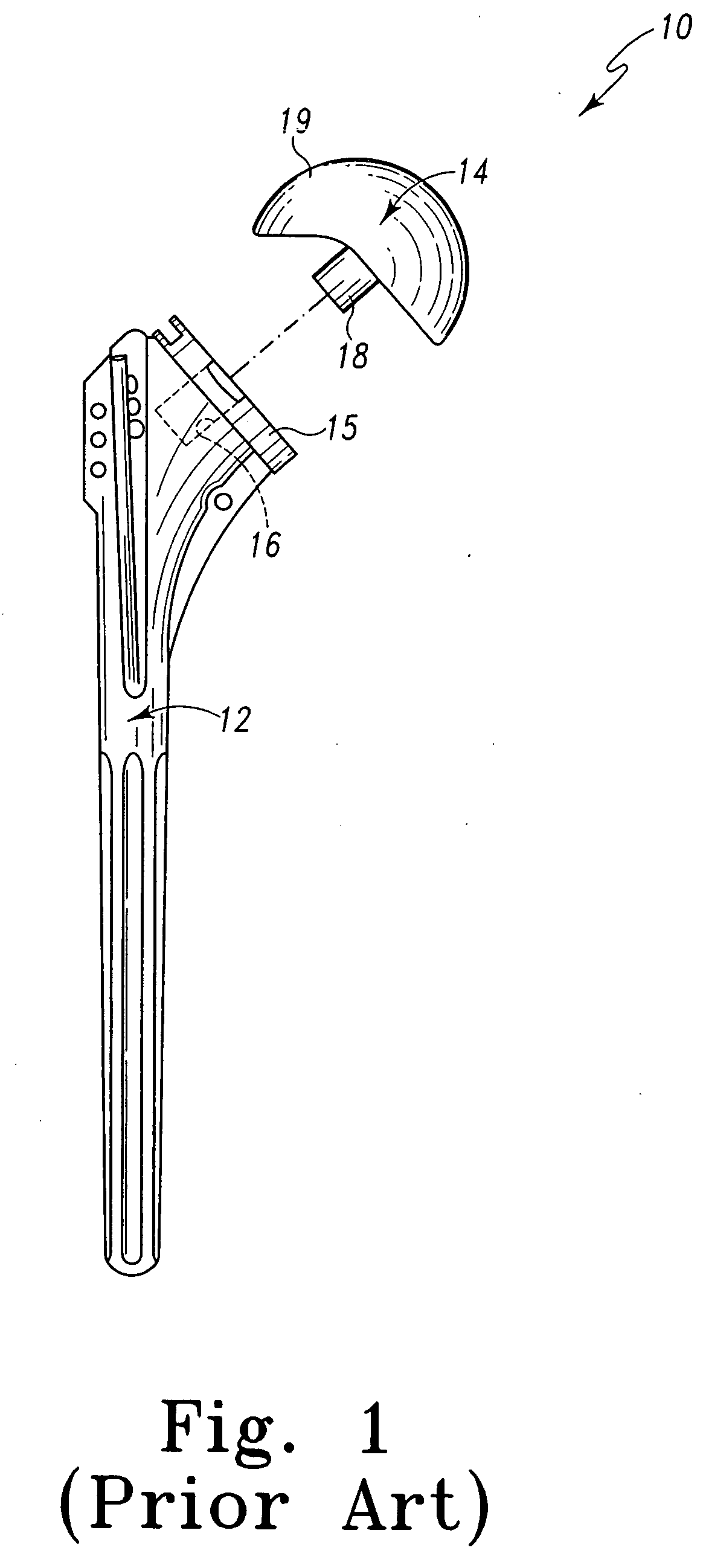 Joint prosthesis with positionable head