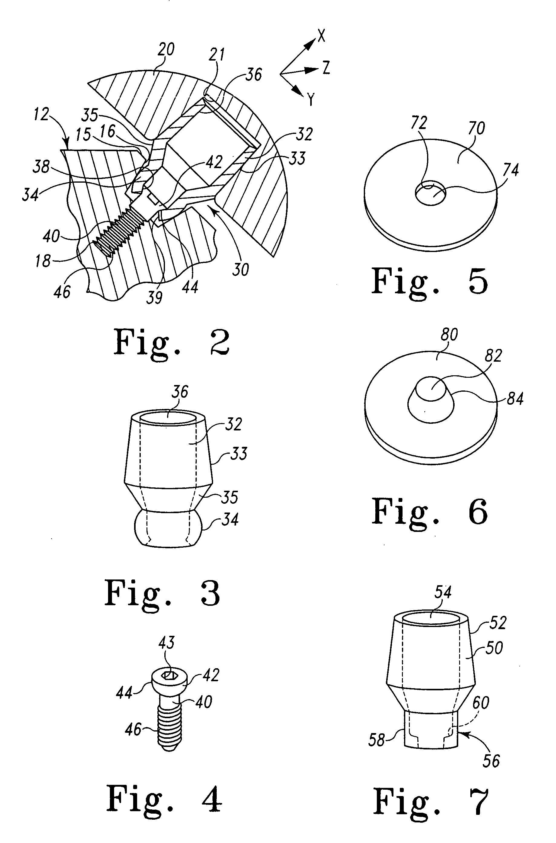 Joint prosthesis with positionable head