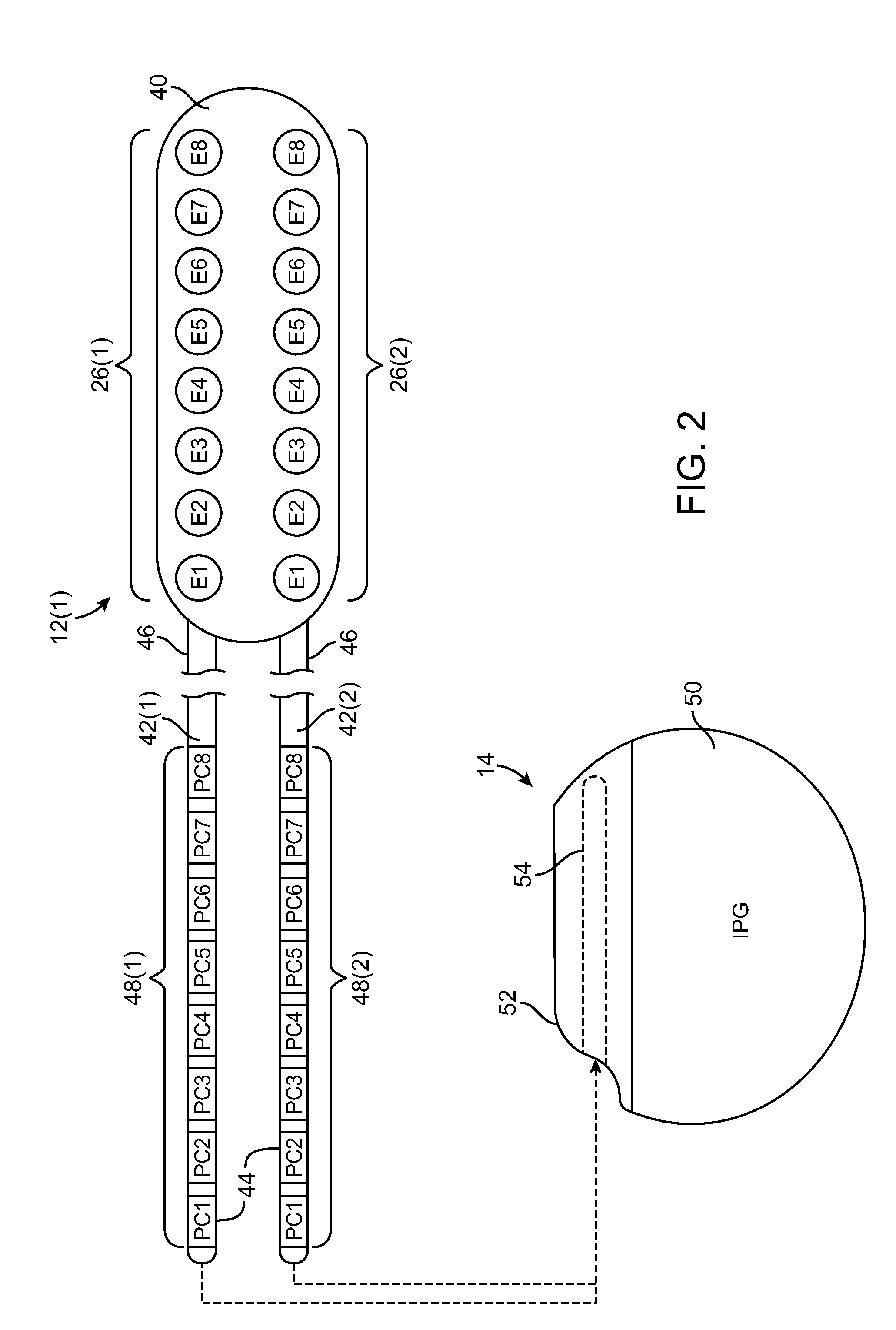 Automatic lead identification using electric field fingerprinting