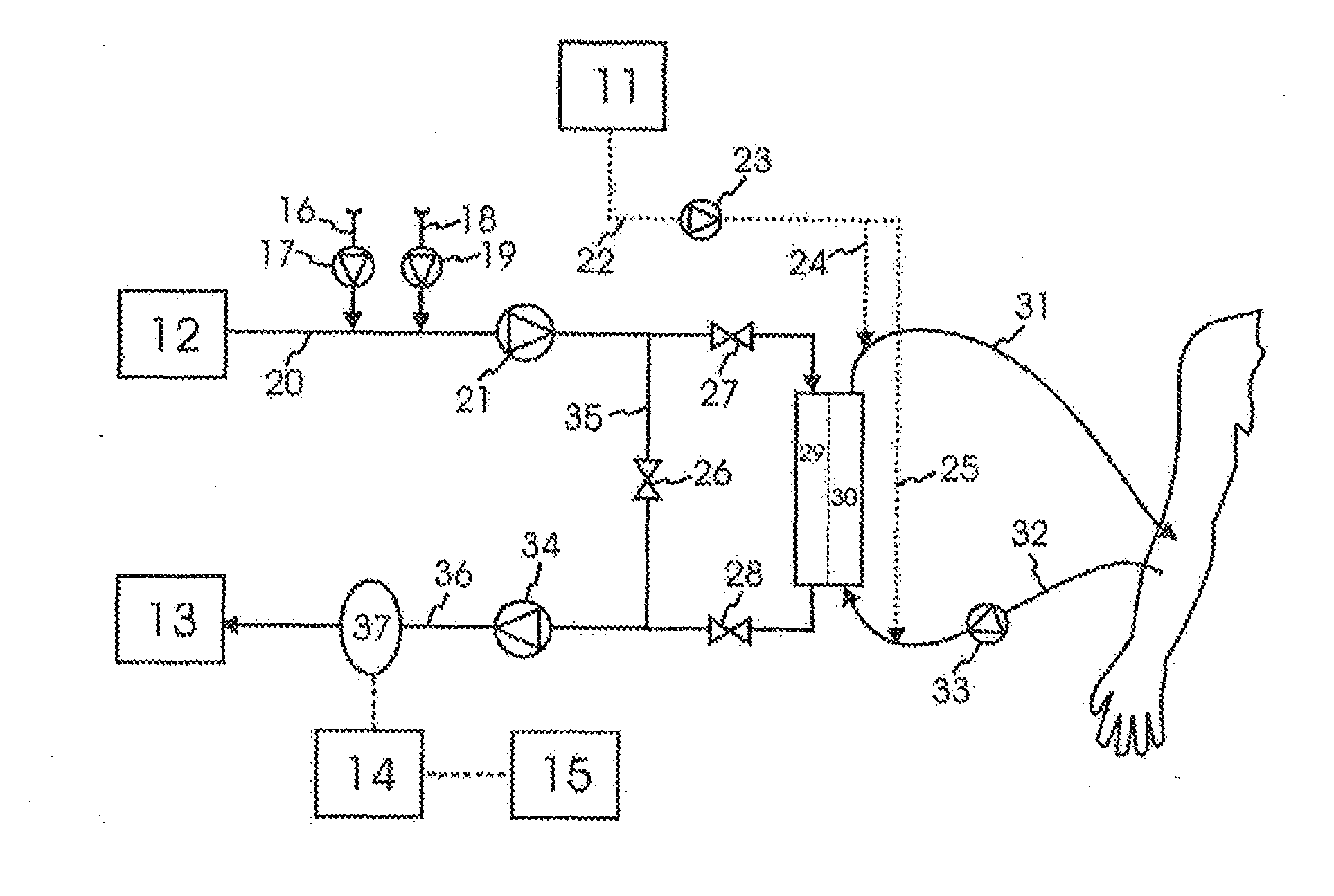 Apparatus for extracorporeal blood treatment, comprising a measuring device for determining the luminescence of the spent dialysate