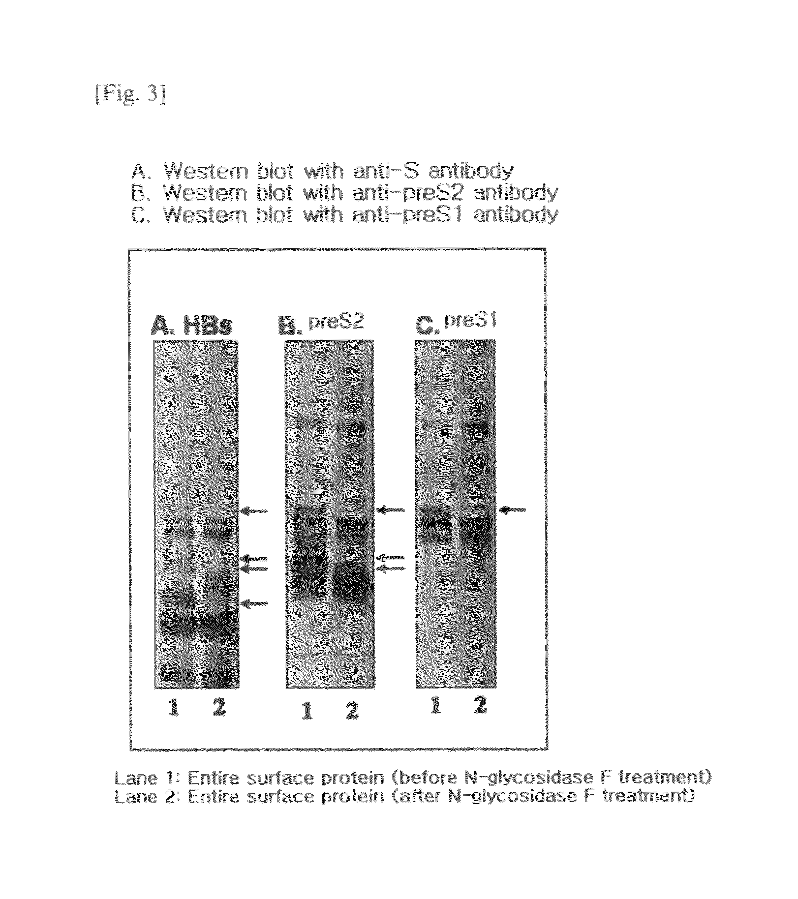 HBV vaccine and a process of preparing the same