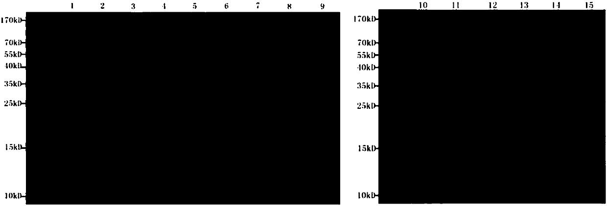 Urine protein marker for malignant hypertensive renal injury and diagnostic use thereof