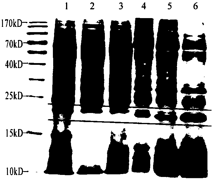 Urine protein marker for malignant hypertensive renal injury and diagnostic use thereof