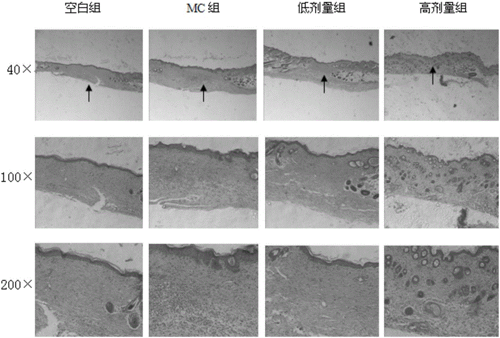 Stem cell culture supernate gel and preparation method thereof