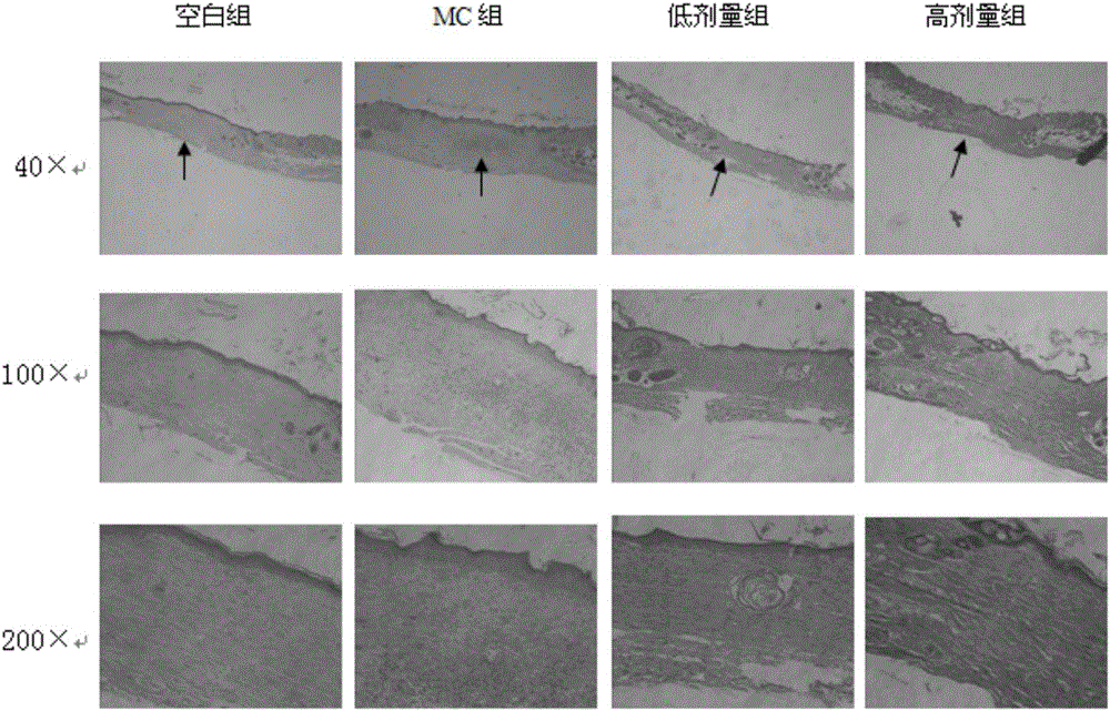 Stem cell culture supernate gel and preparation method thereof