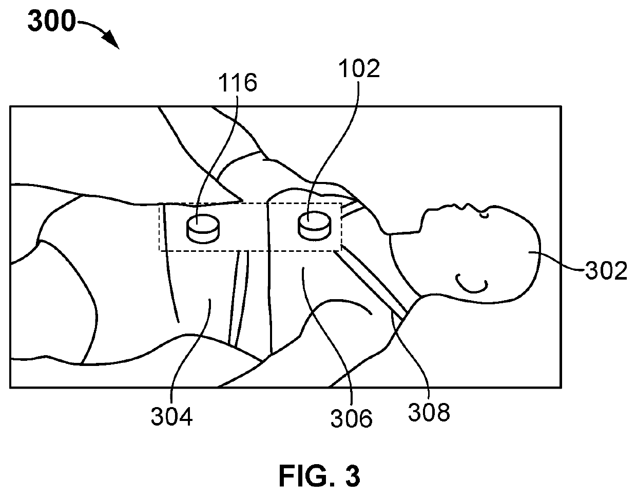 System and method for optimizing diaphragmatic breathing