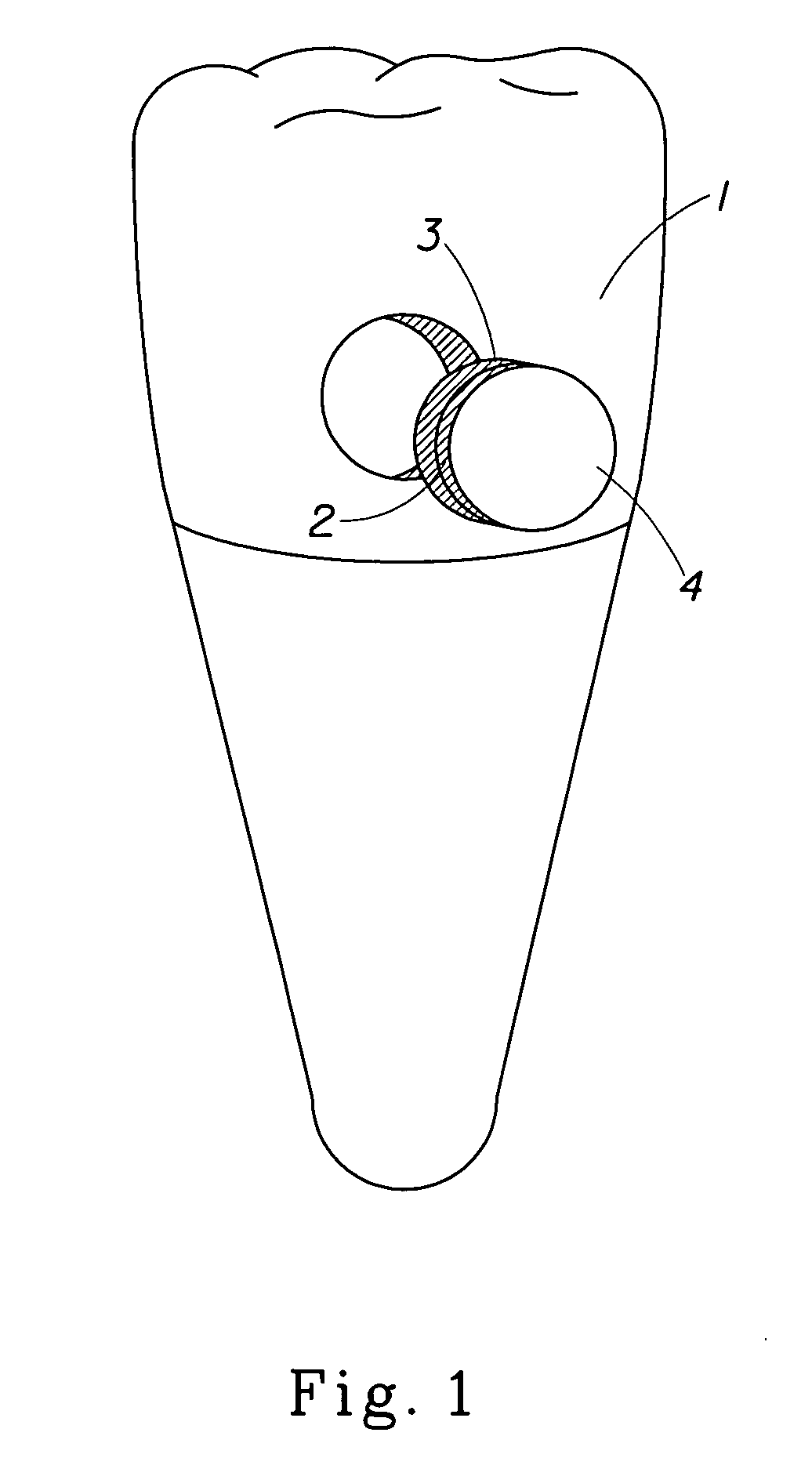 Methods for evaluating anticaries efficacy in occlusal surfaces of teeth