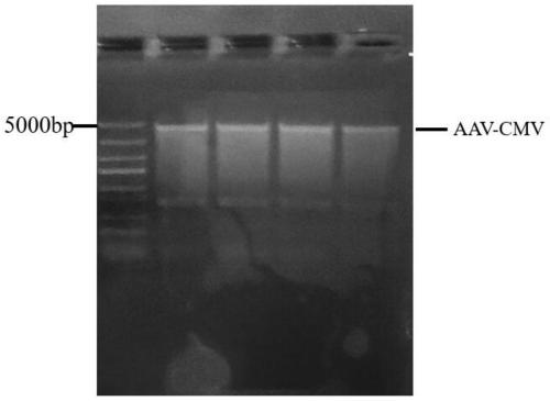 Anti-pathogen hyperimmune yolk antibody, AAV vector vaccine based preparation method and preparation