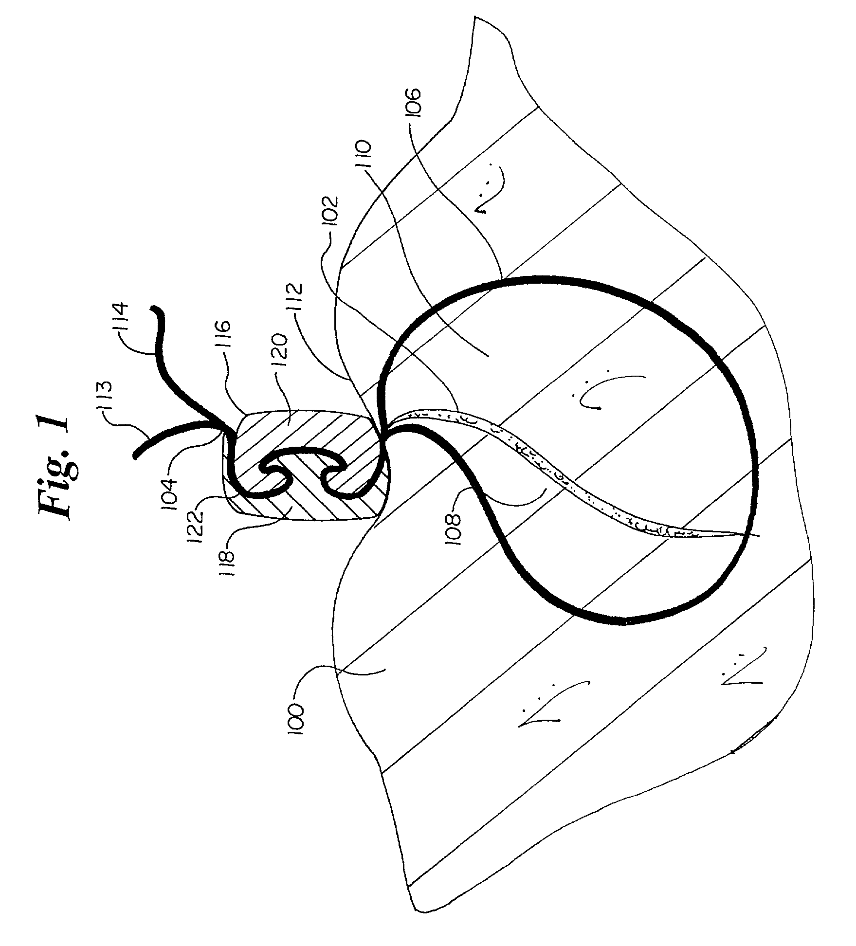 Suture lock having non-through bore capture zone