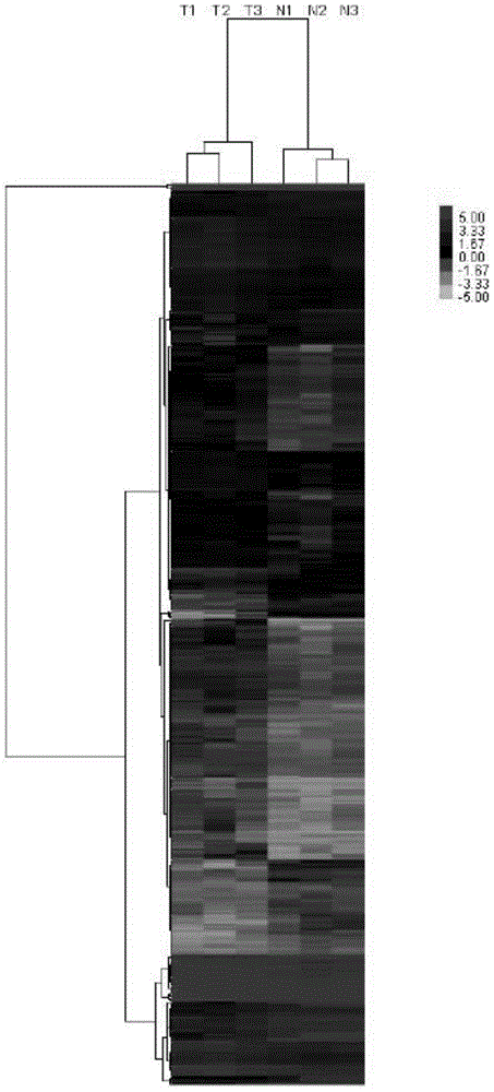 Detection method and application of long-chain non-coded RNA for screening bladder cancer