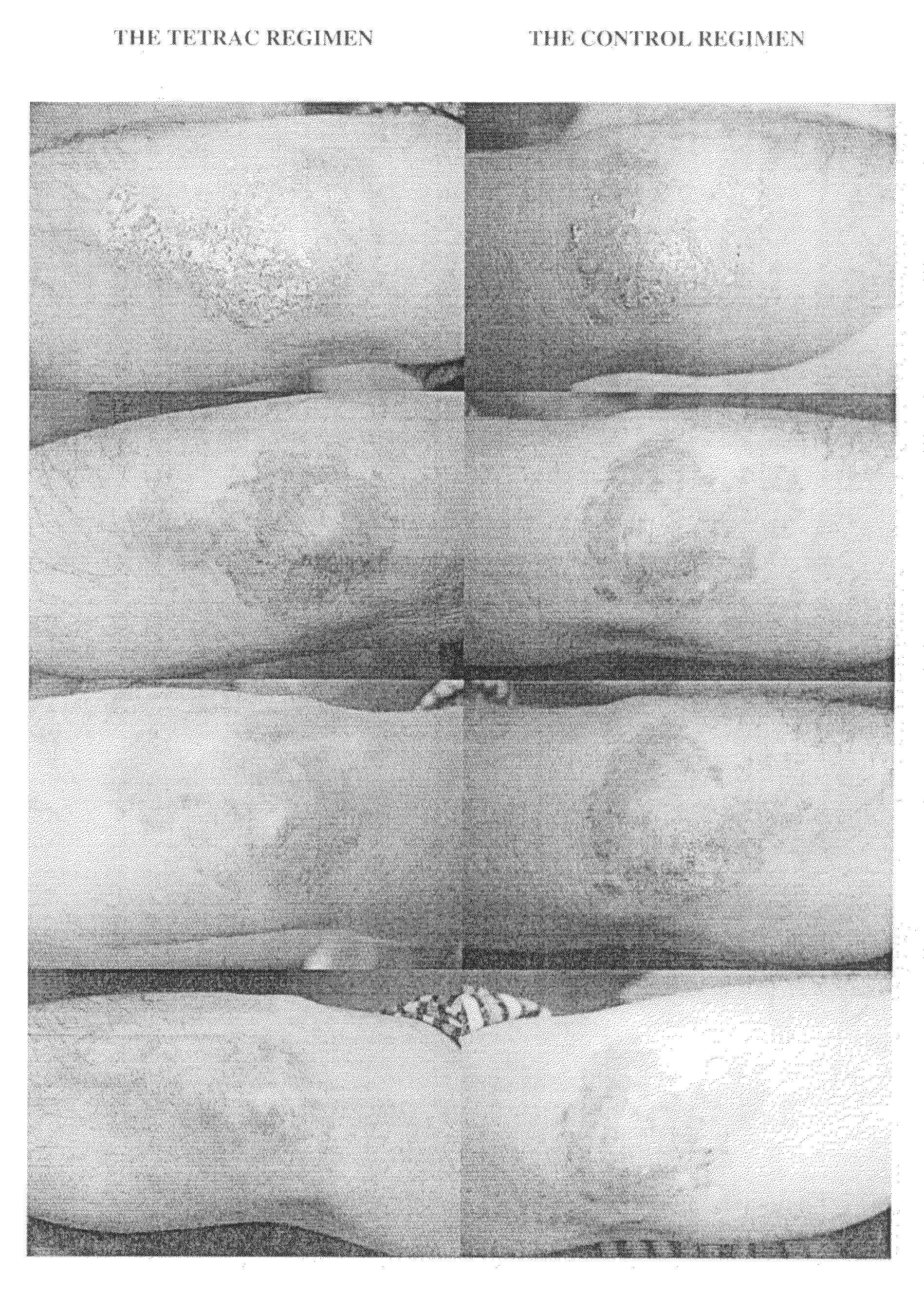 Novel pharmaceutical composition for topical treatment of skin psoriasis and the treatment method thereof