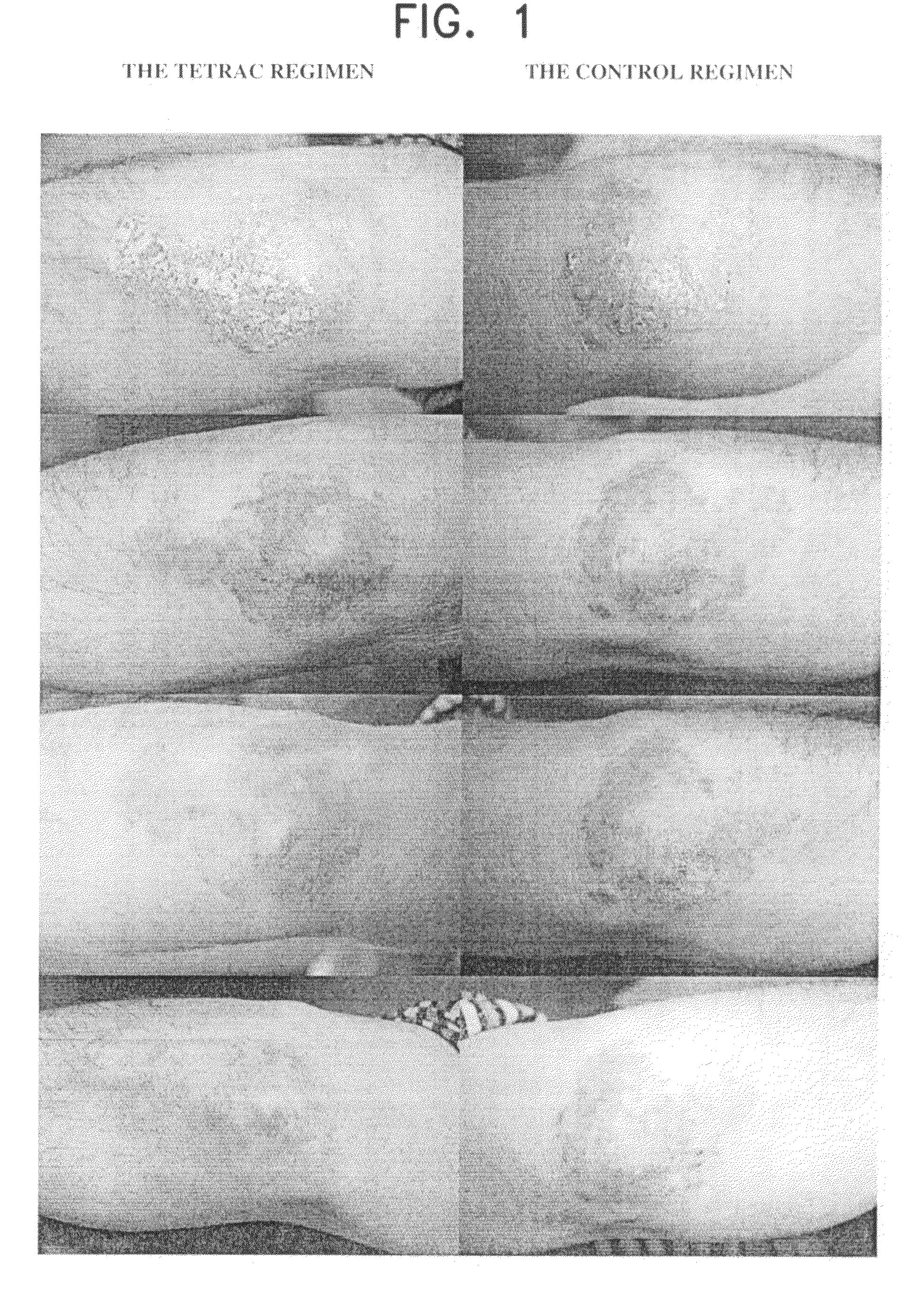 Novel pharmaceutical composition for topical treatment of skin psoriasis and the treatment method thereof