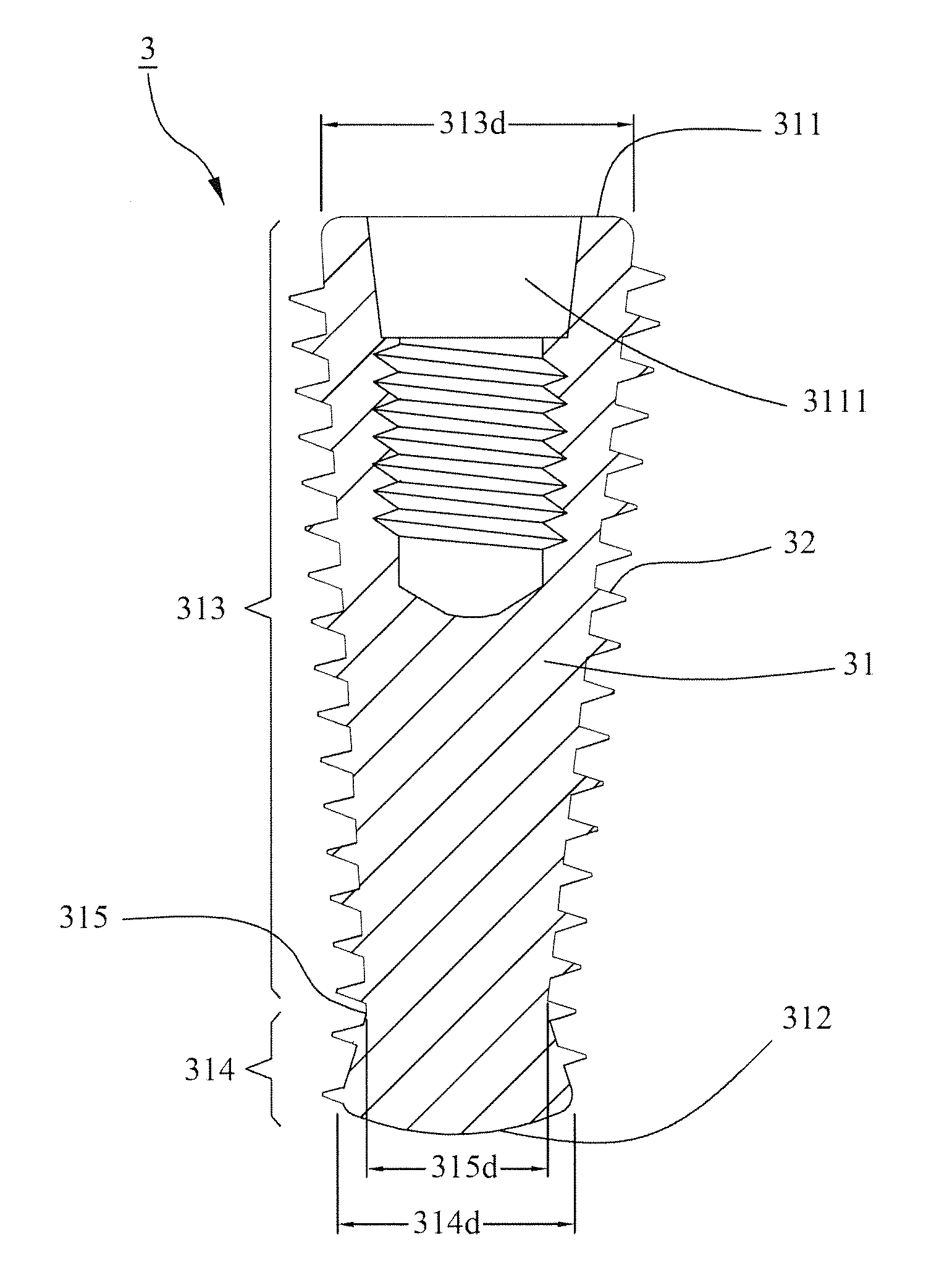 Dental implant with high combining stability