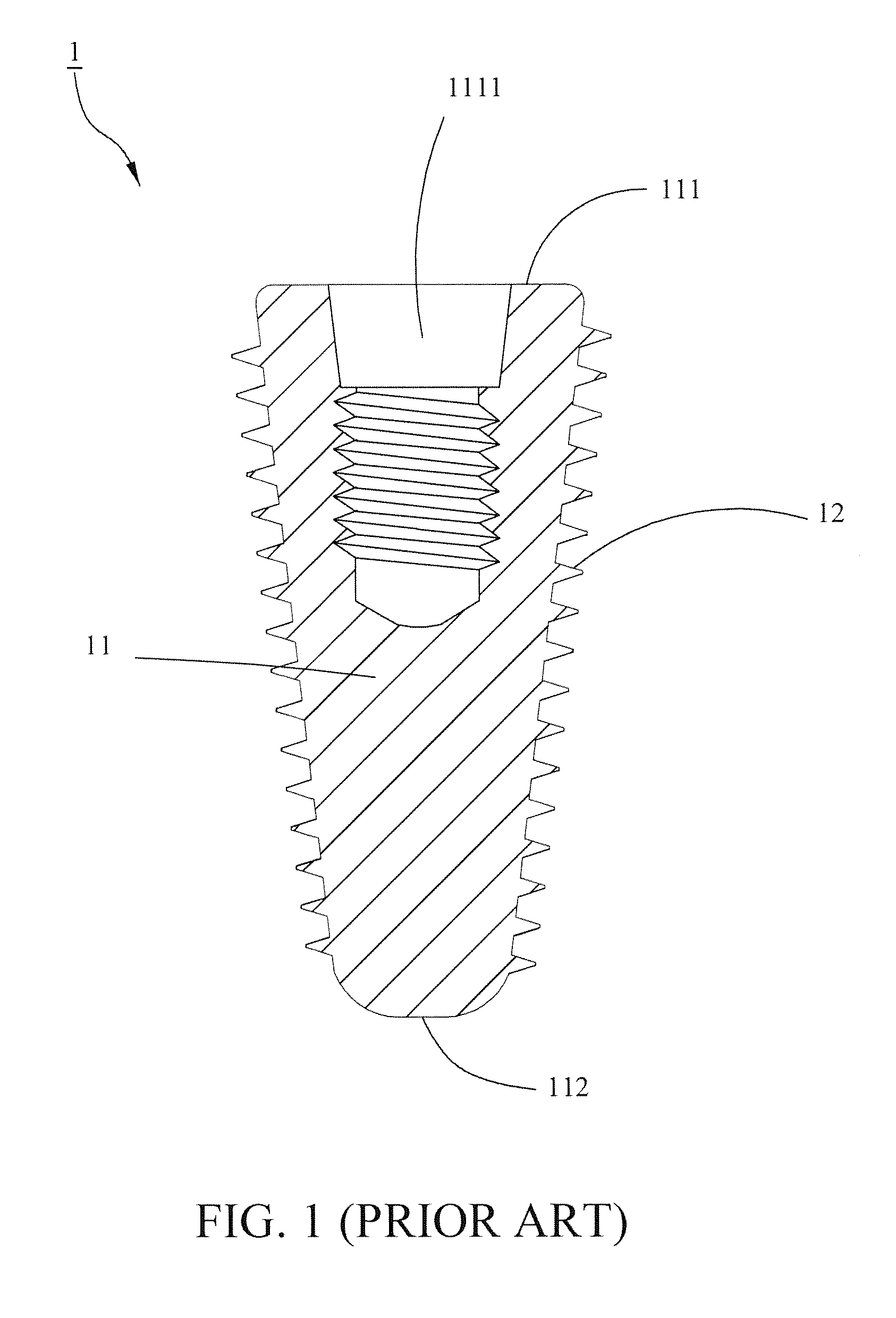 Dental implant with high combining stability