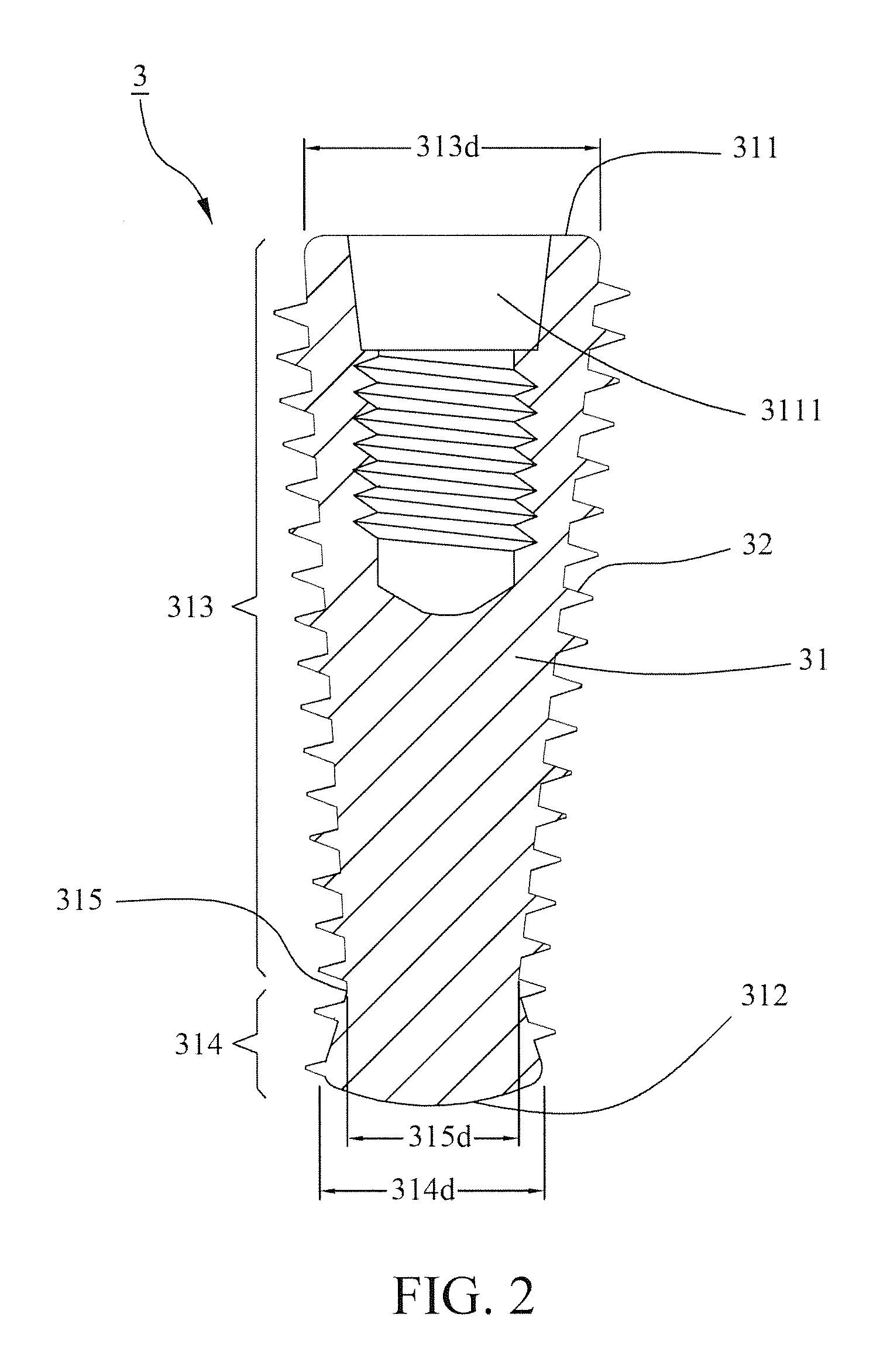 Dental implant with high combining stability