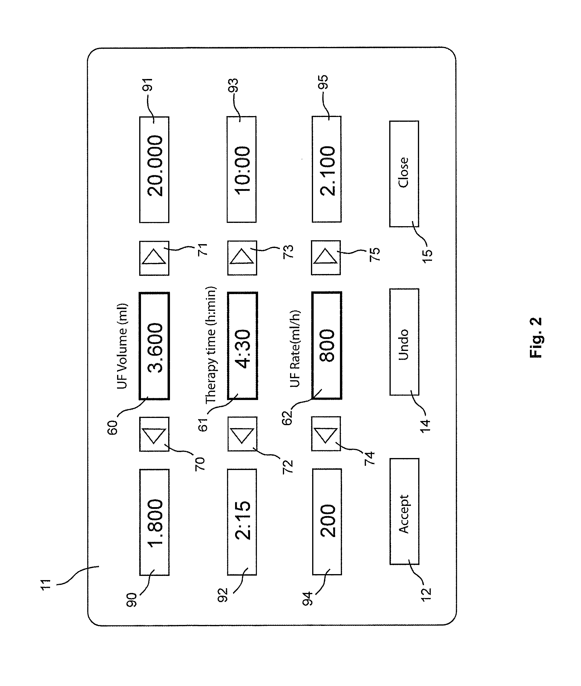 Batch parameter settings in a medical apparatus