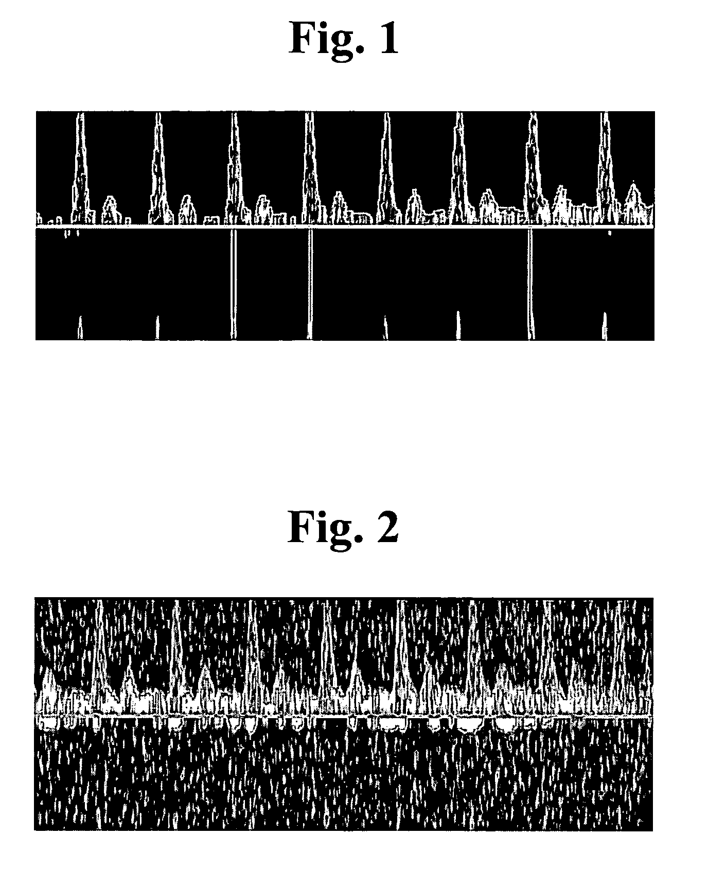 Apparatus and method for processing an ultrasound spectrum image