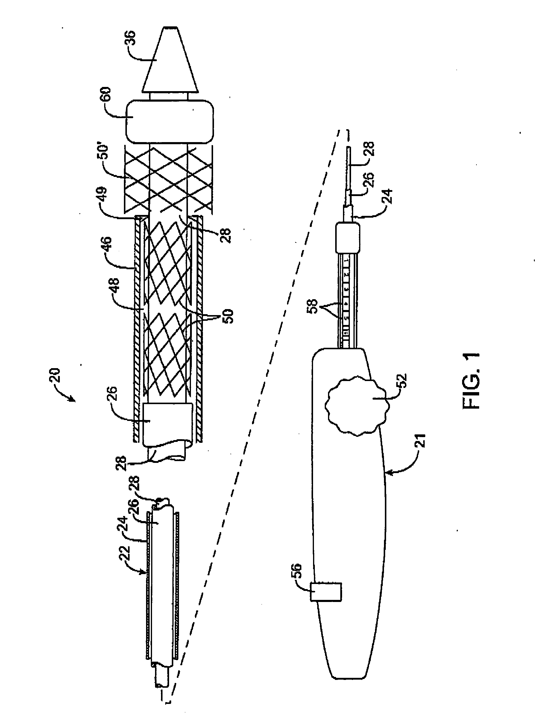 Custom-length self-expanding stent delivery systems with stent bumpers