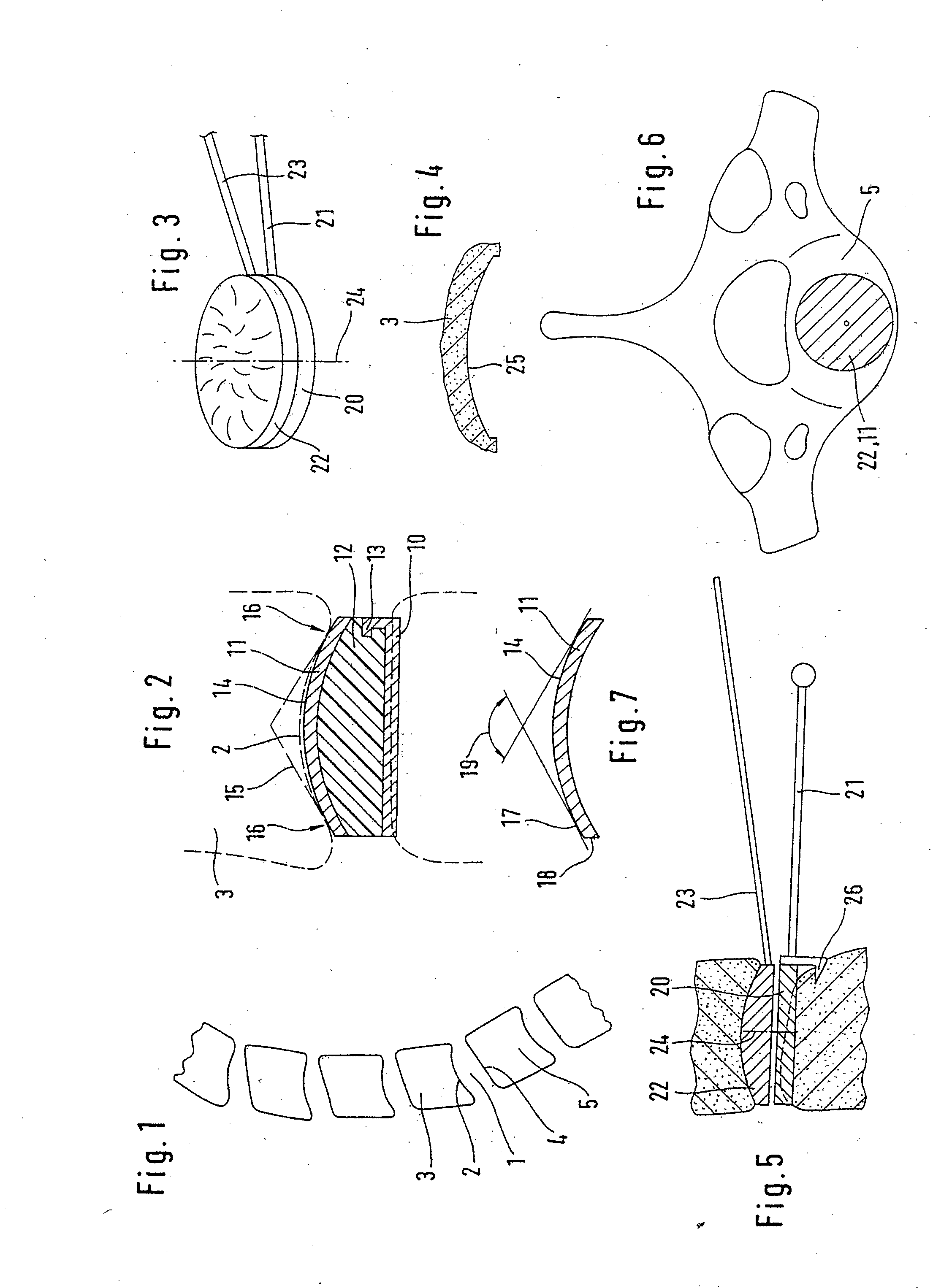 Cervical prosthesis and instrument set