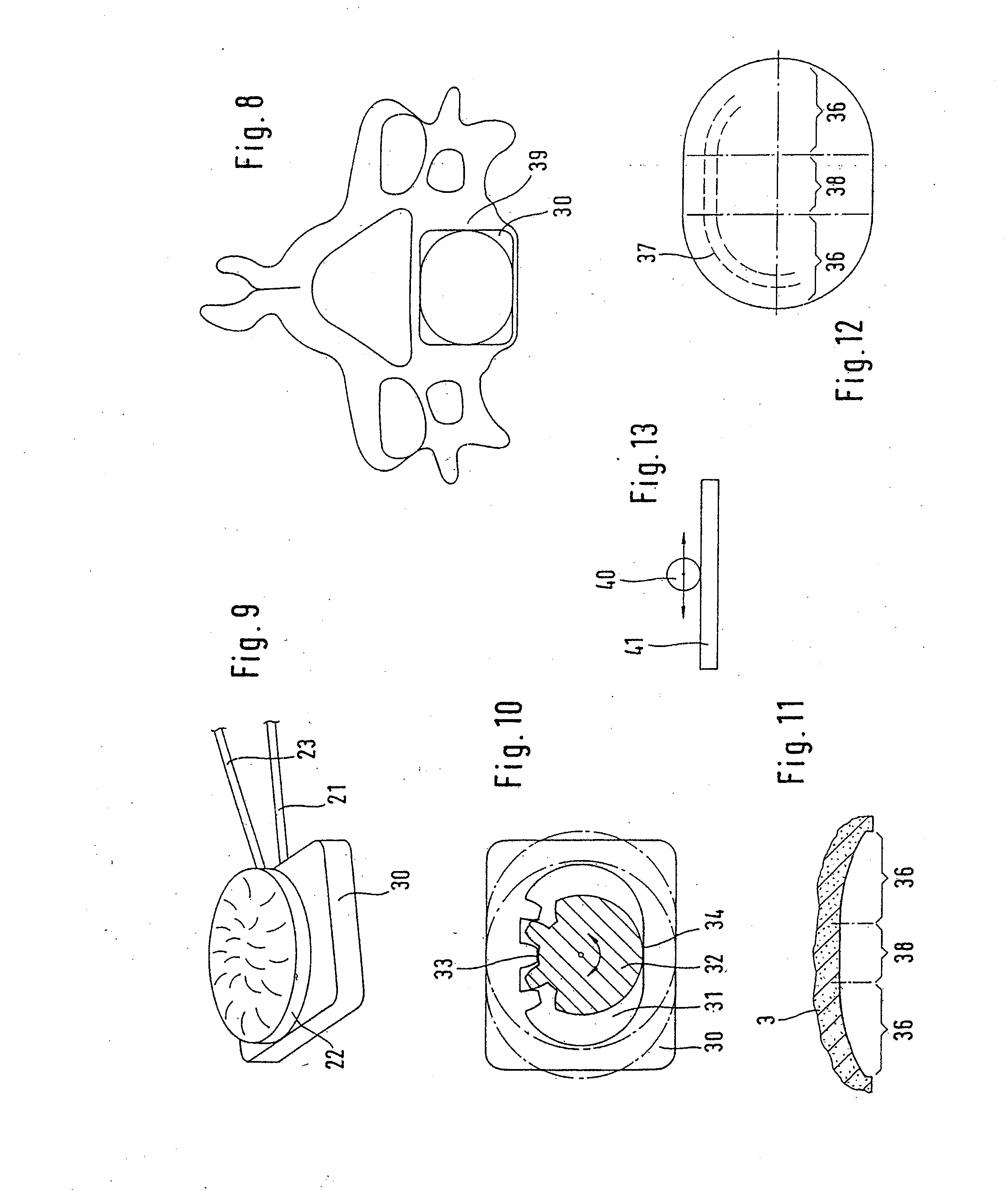 Cervical prosthesis and instrument set