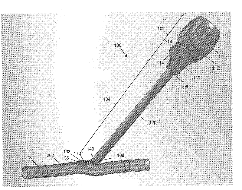 Vessel access and closure device