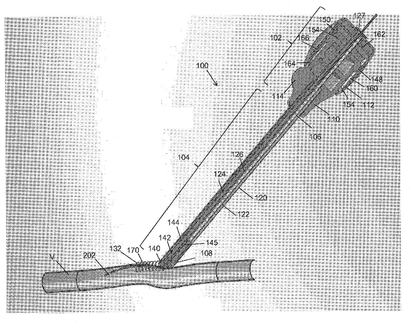 Vessel access and closure device