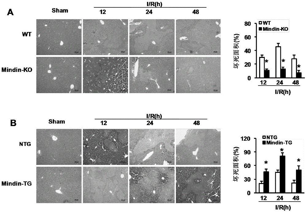 Application of gene Mindin in hepatic ischemia reperfusion injury