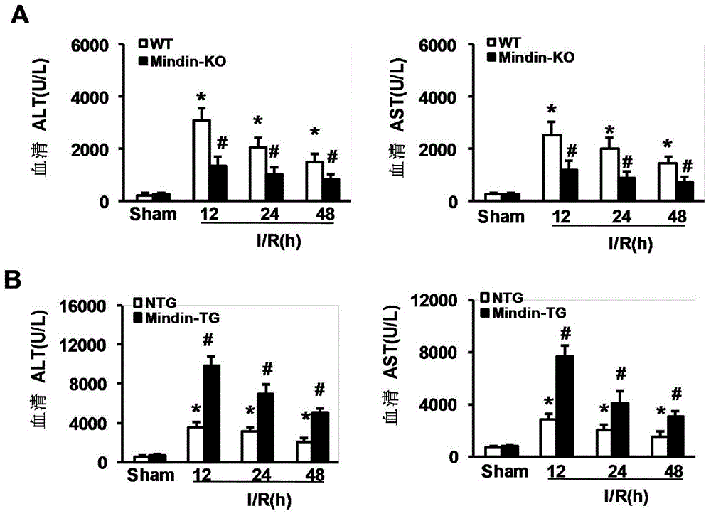 Application of gene Mindin in hepatic ischemia reperfusion injury