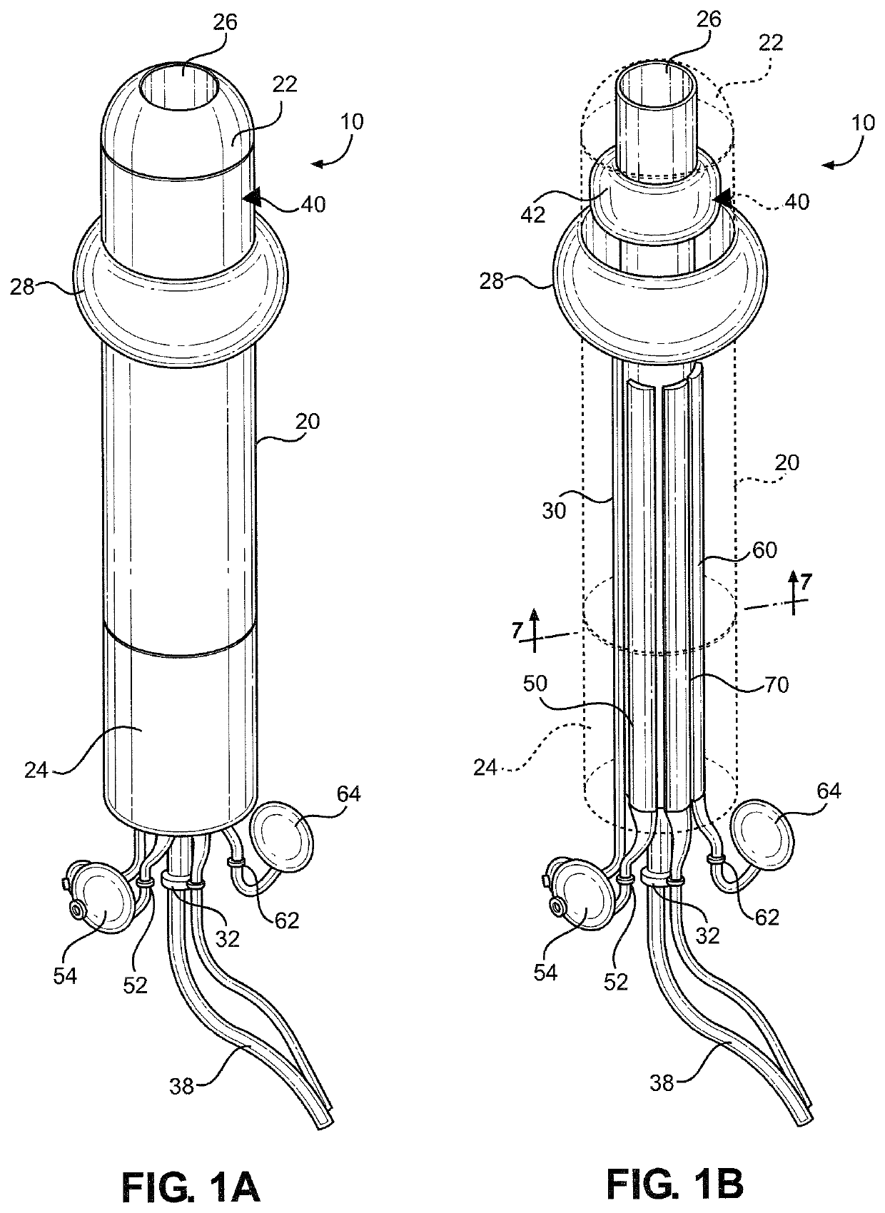 Self-washing catheter