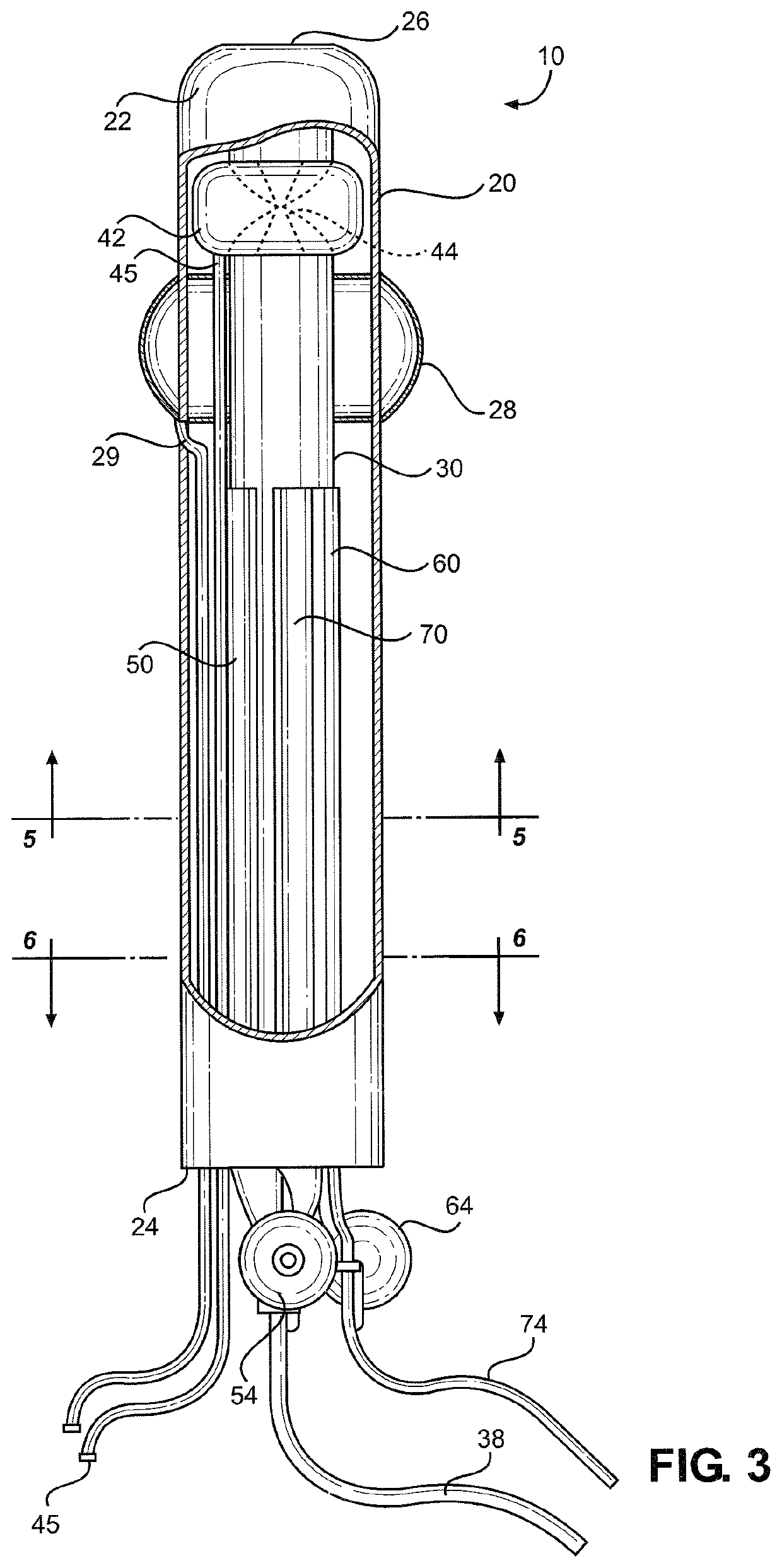 Self-washing catheter