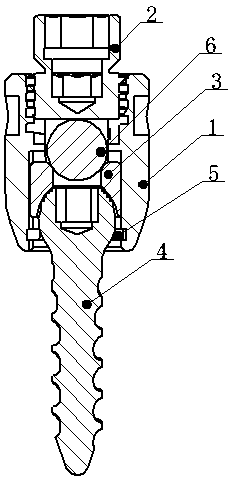 Polyaxial pedicle screw fixing device with self-breaking screw