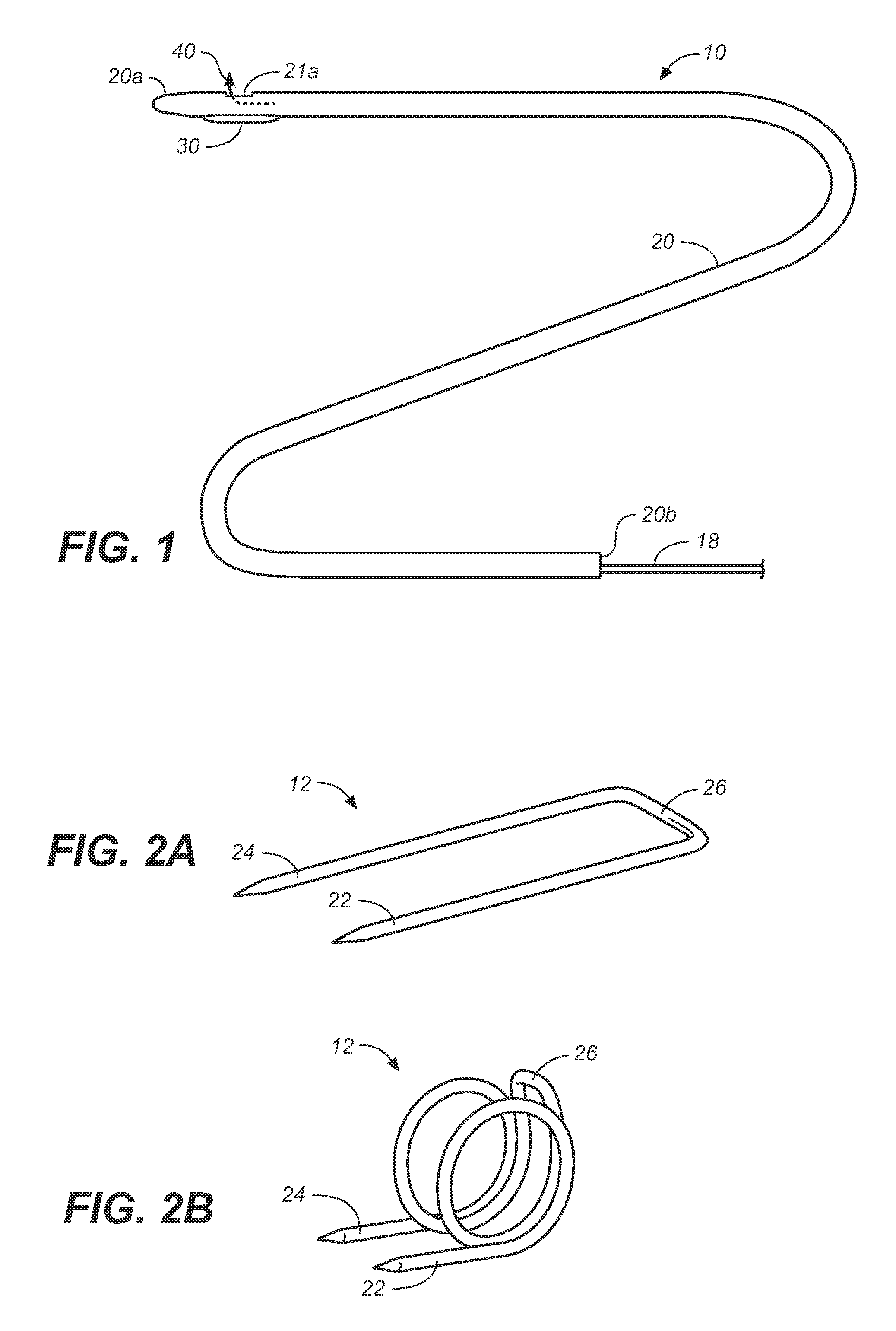 Prosthesis Fixation Apparatus and Methods