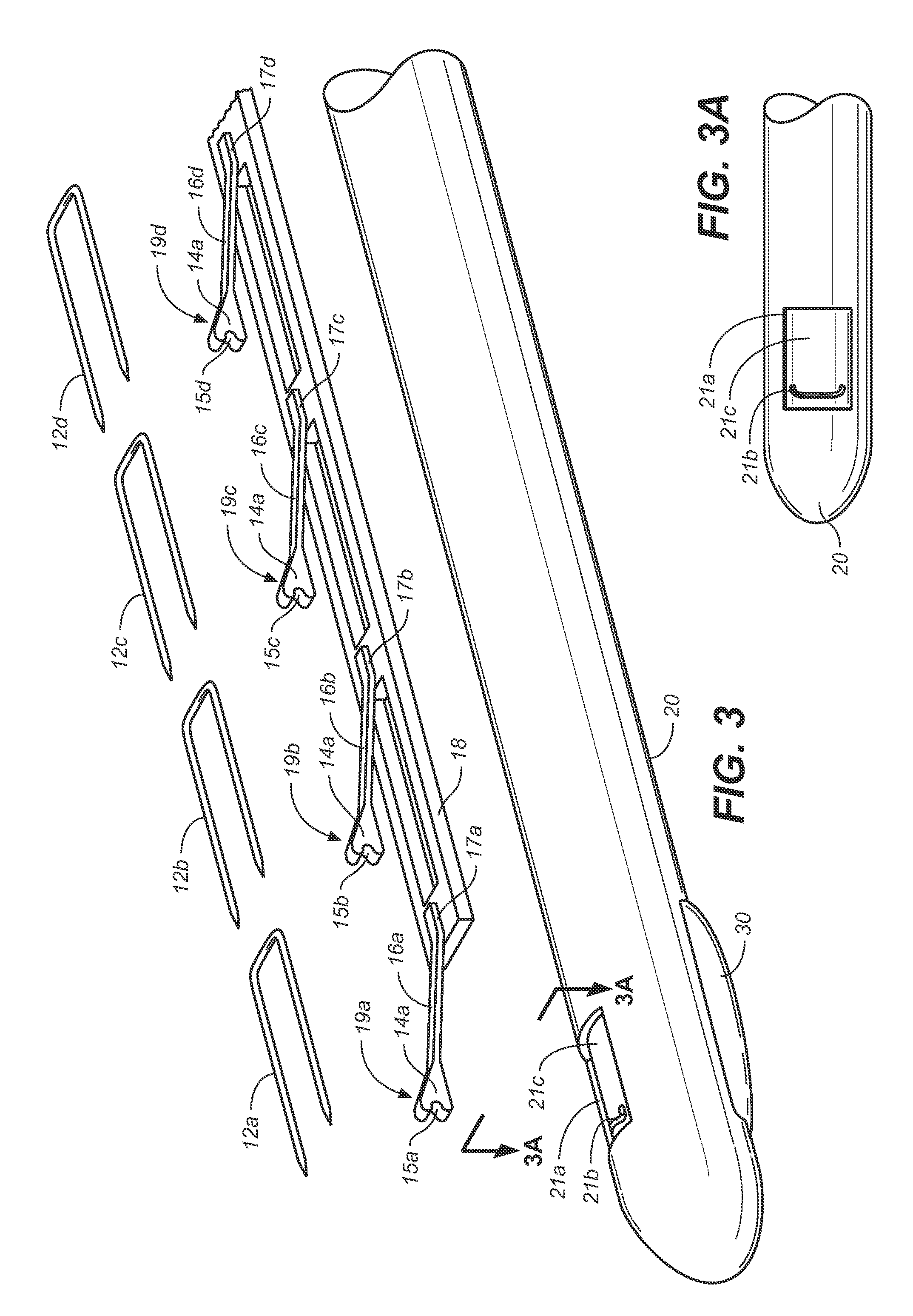 Prosthesis Fixation Apparatus and Methods