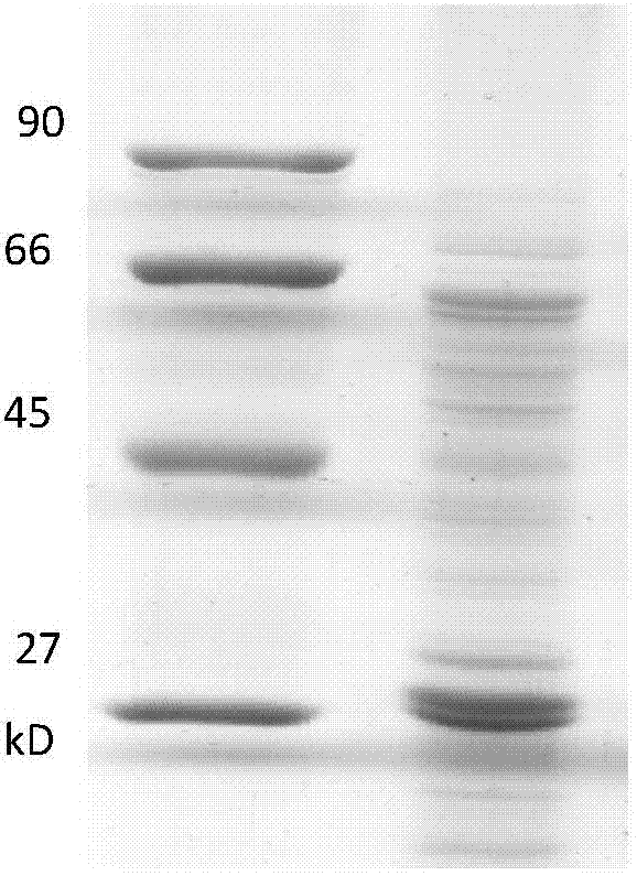 Bacillus thuringiensi strain, combination protein and application of protein