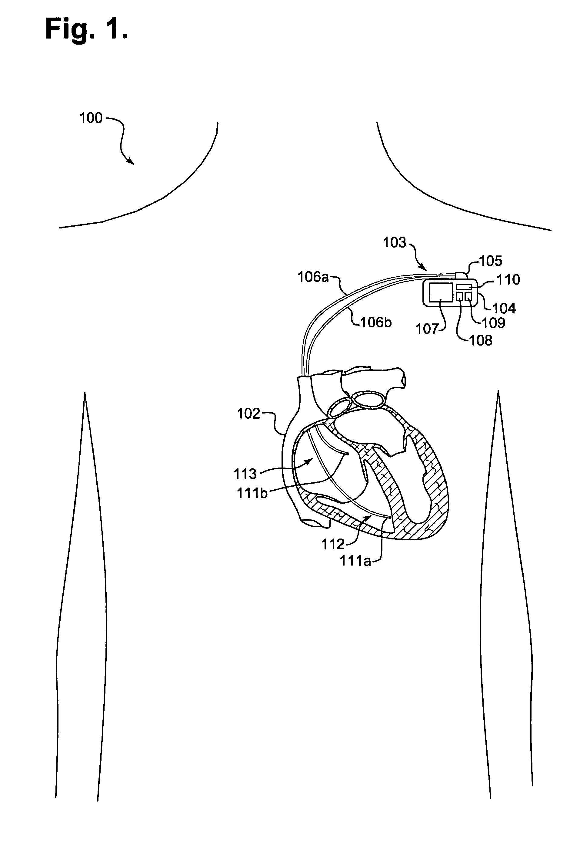 Ambulatory repeater for use in automated patient care and method thereof