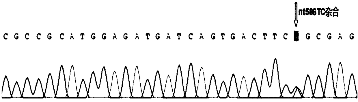 SNP site of B variant blood type triggering acute hemolytic transfusion reaction