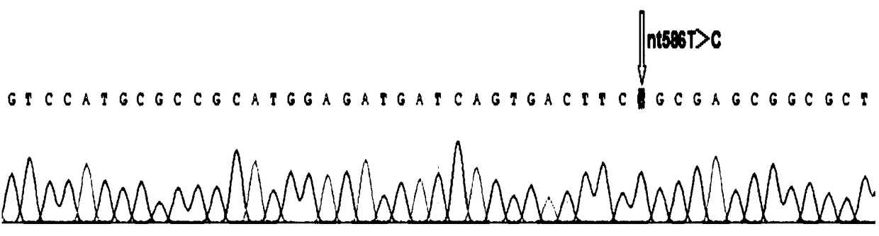 SNP site of B variant blood type triggering acute hemolytic transfusion reaction