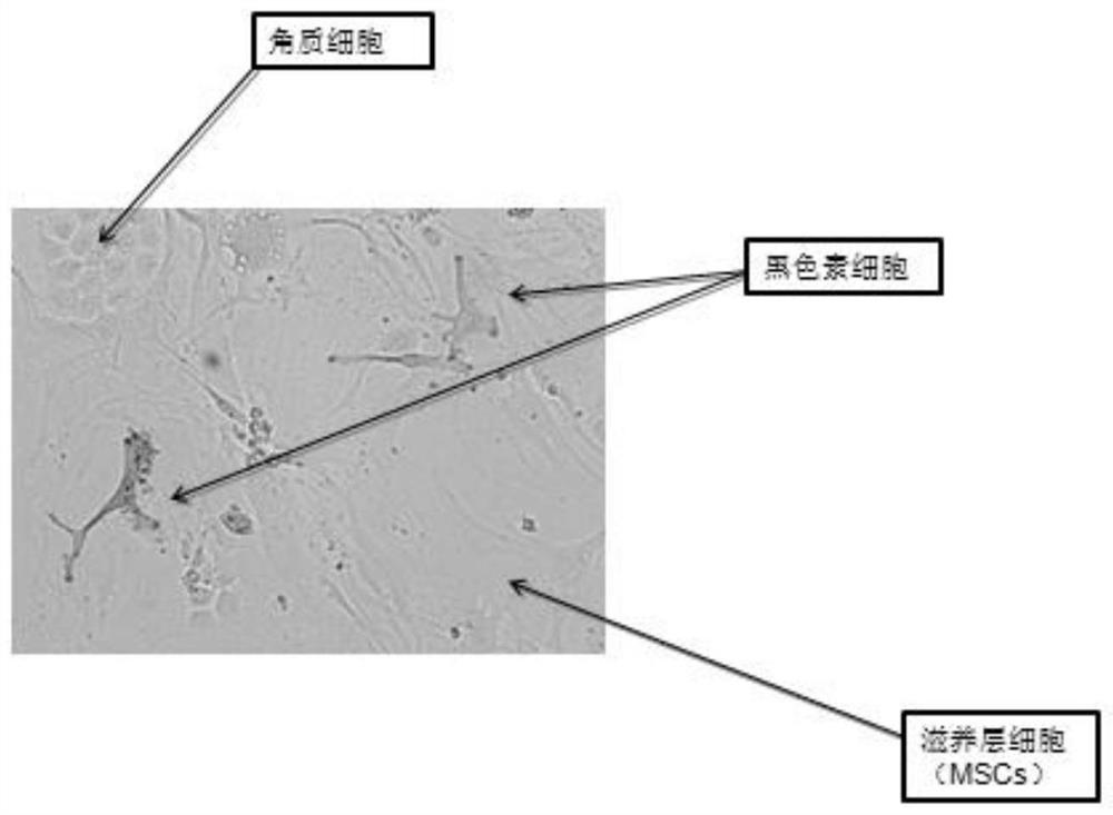 A kind of culture method and culture medium of autologous tissue engineered epidermis