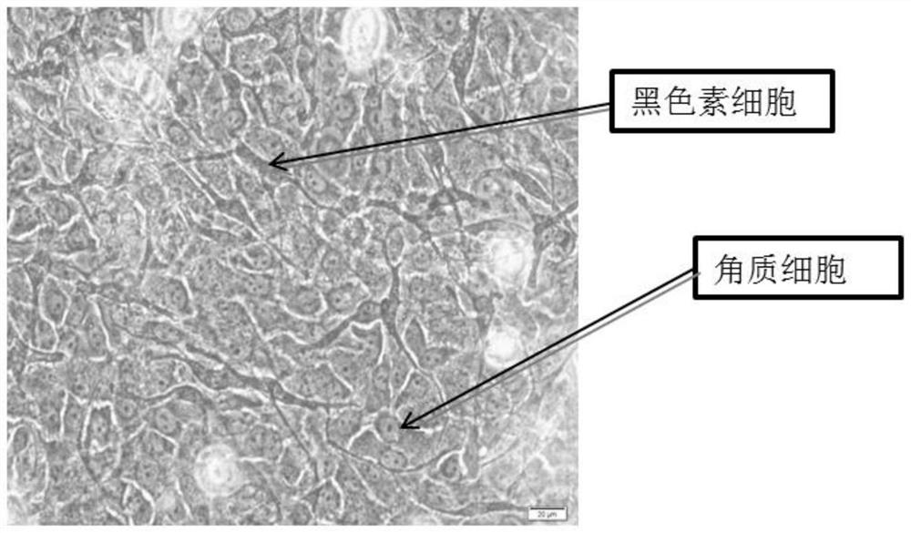 A kind of culture method and culture medium of autologous tissue engineered epidermis