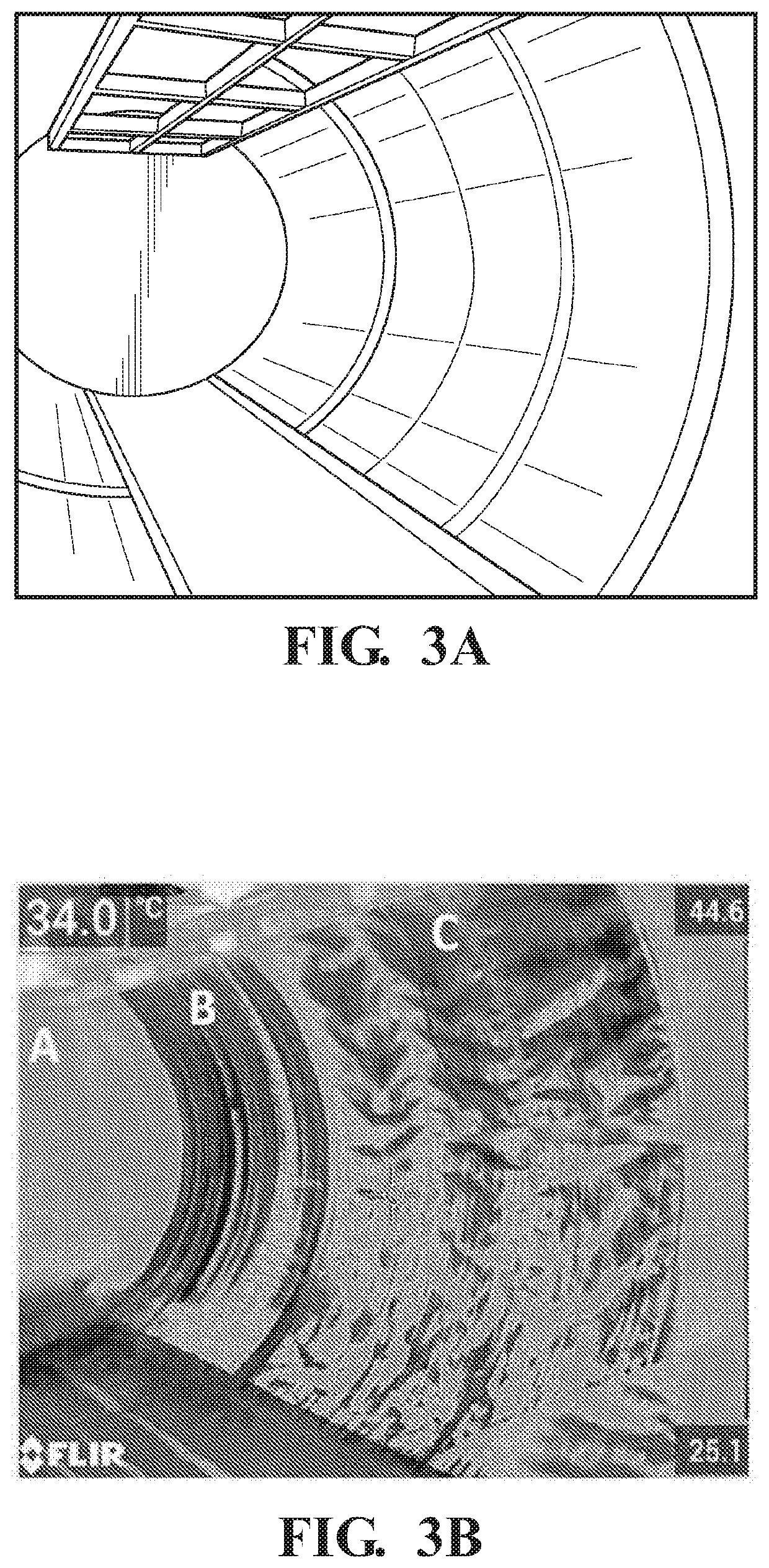 Radio frequency treatment to phytosanitize wood packaging materials used in international shipping