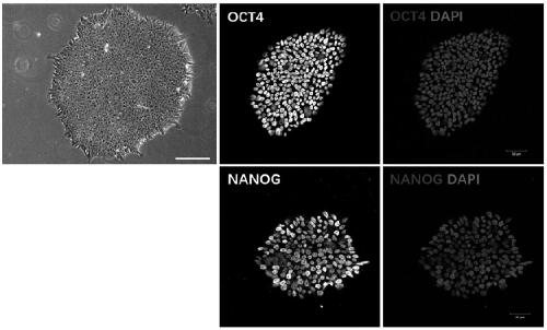 Neural crest-lineage pericyte derived from multi-potential stem cells and induced differentiation method of neural crest-lineage pericyte